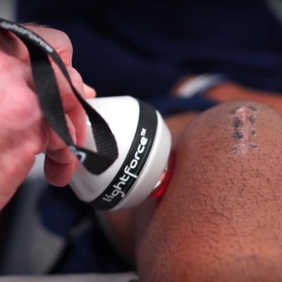 A knee with a laser device scanning it